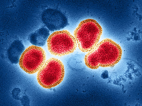 Virus de la influenza H3N2 es detectable por los paneles respiratorios de BIOFIRE® FILMARRAY® de bioMerieux