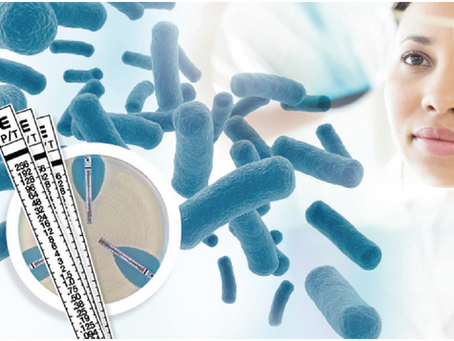 ETEST® de bioMérieux 