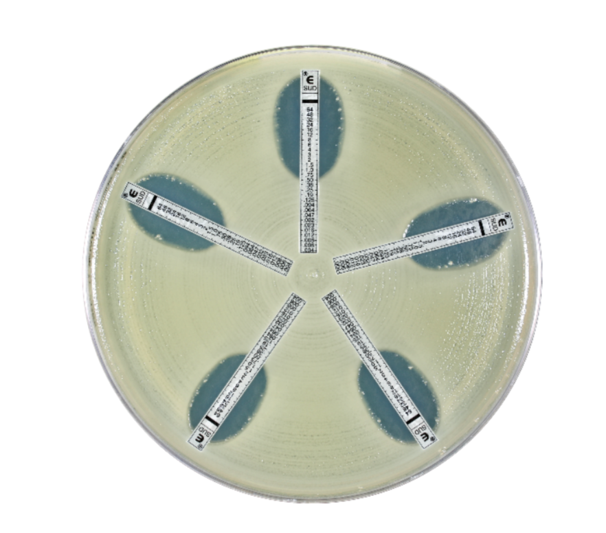 ETEST® son las tiras reactivas cuantitativas de antibiograma de bioMérieux que determinan la Concentración Inhibitoria Mínima (CIM) a escala y apoyan a los clínicos a instaurar el tratamiento correcto.