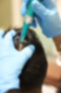 dermapen