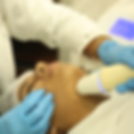 hifu_treatment