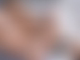 Before You Moisturize, Prep Your Skin with Hypochlorous Acid Spray