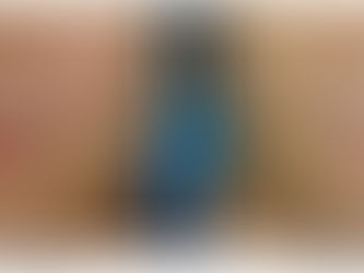 Complications of Thread Lift and How to Manage: Thread Protrusion, Infection, Dimpling and Bruising