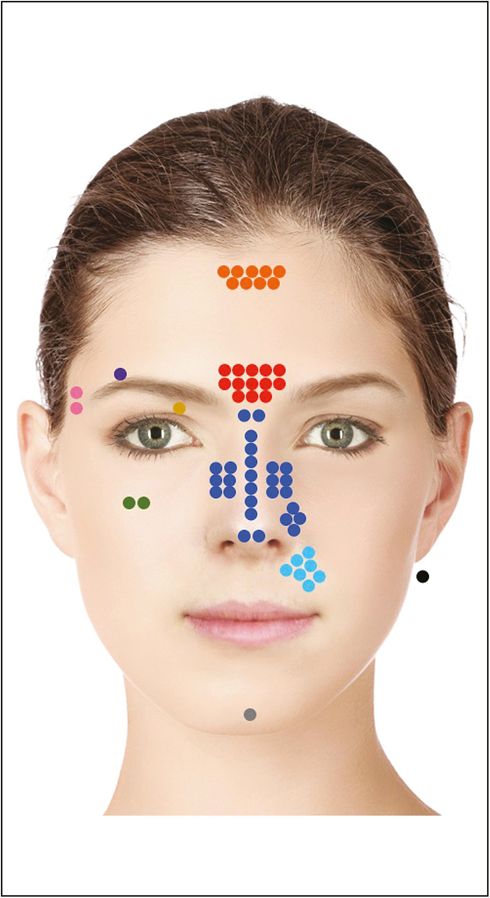 Number of cases per location of filler injection resulting in visual complication