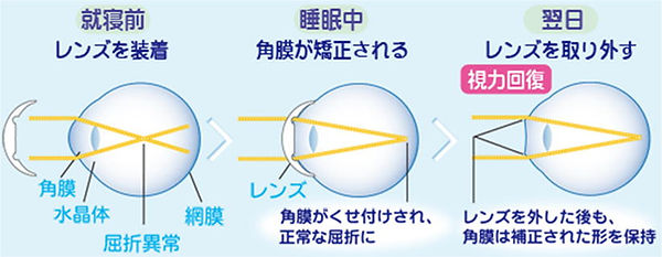 オルソ画像1.jpg