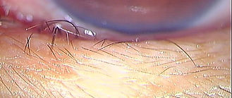 0035537_20161121_100912_l_スリット_edited.jp