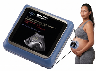 Sonus Microsystems’ Autonomous Ultrasound AI Platform Selected for Major ARPA-H Maternal Health Award