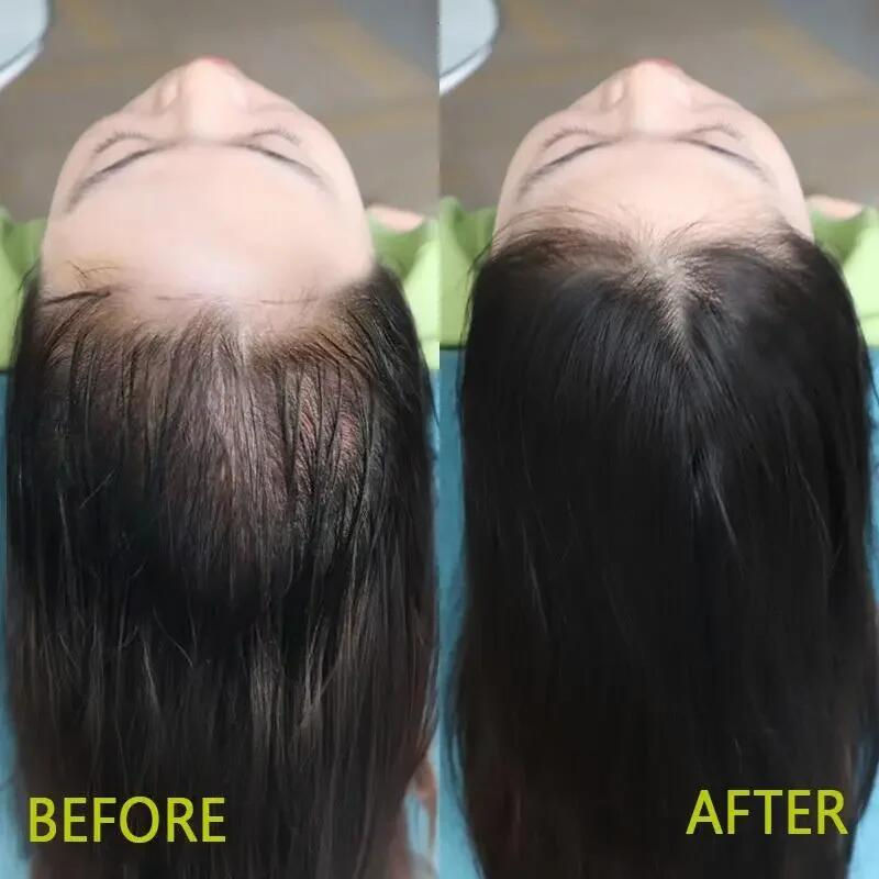 Miniatura: Fast Ginger Hair Growth Spray Roots Grow Anti Hair Loss Hair Regrowth Serum Scal
