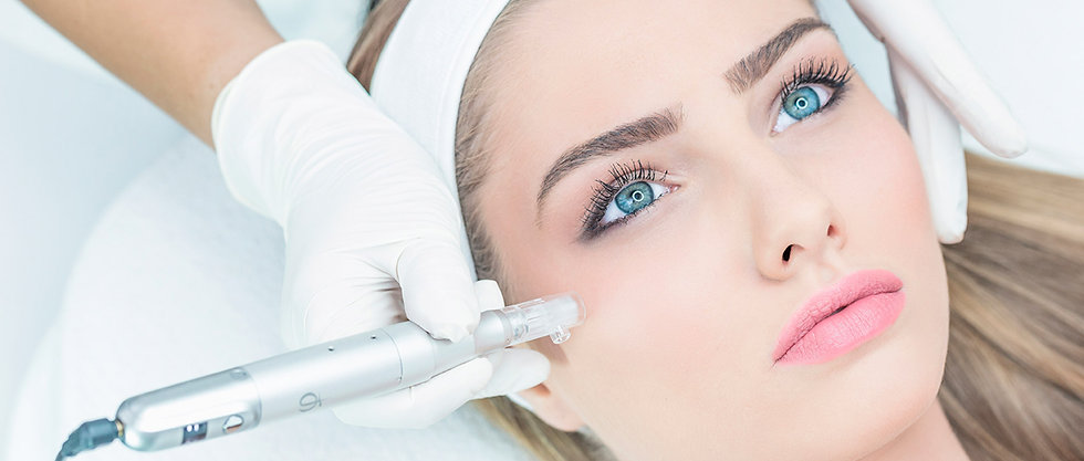 microneedling2.jpeg