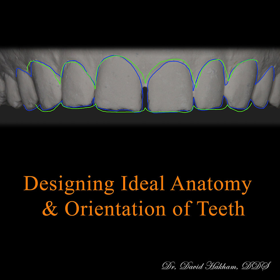 Blue and green outlines comparing existing and proposed upper front tooth contours.