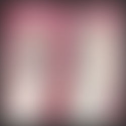 Key Advantages of Biomimetic Porcelain Onlays vs. Zirconia Dental Crowns