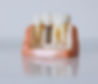 Dental Implants in Montebello CA