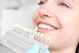 Bright, healthy smile after cosmetic dentistry treatment