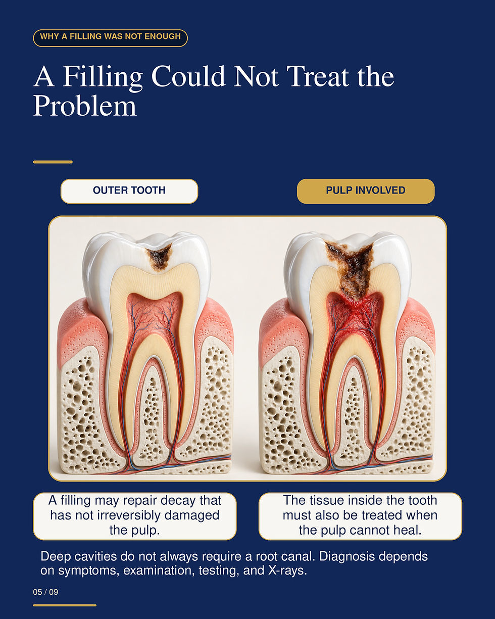 Tooth model comparison showing outer tooth decay beside deeper decay involving the pulp.