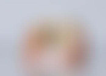 What Are The Best Dental Implants As A Replacement For Missing Teeth?