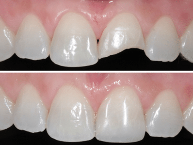 Saiba quando procurar um especialista em dentÃstica