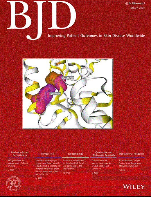 A picture of the British Journal of Dermatology featuring an article on NICE acne vulgaris guidelines and a summary of the changes for dermatologists by Dr Bryan McDonald (co-author) consultant dermatologist, London, UK.  