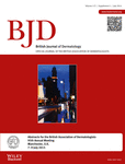 | drbryan | doctor bryan | dr mcdonald | dr bryan mcdonald | dermatology | dermatologist | paediatric dermatology | paediatric dermatologist | male genital dermatology | dick doctor | rash | skin rash | mole | melanoma | squamous cell carcinoma | basal cell carcinoma | wart | actinic keratosis | seborrhoeic keratosis | aesthetic dermatology | aesthetic surgery | biopsy | excision | skin surgery | eczema | psoriasis | hidradenitis suppurativa | urticaria | acne vulgaris | rosacea | skin care | boils | vitiligo | harley street | skin cancer | best dermatologist | top doctor | premium service | headshot of dermatologist | onewelbeck | spire london east | harley street clinic | Whitechapel dermatologist | angel laser centre dermatolgist | skin problems | skin damage | harley street dermatologist |