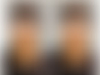 ただ顔が小さくなるだけじゃ満足できない!!という方にこそやってほしい小顔矯正