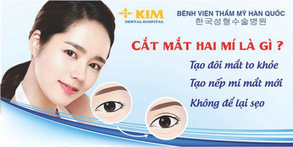 Cắt mắt hai mí ở đâu đẹp an toàn?