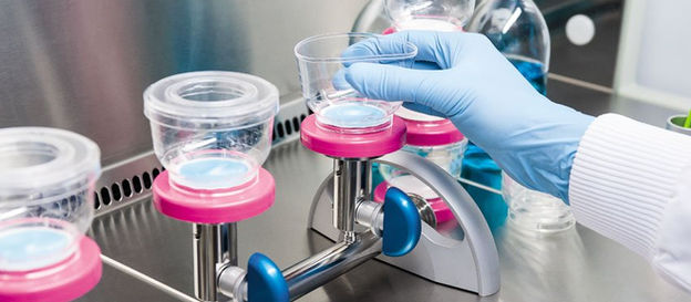 What is the Difference Between Bioburden and Endotoxin Test?