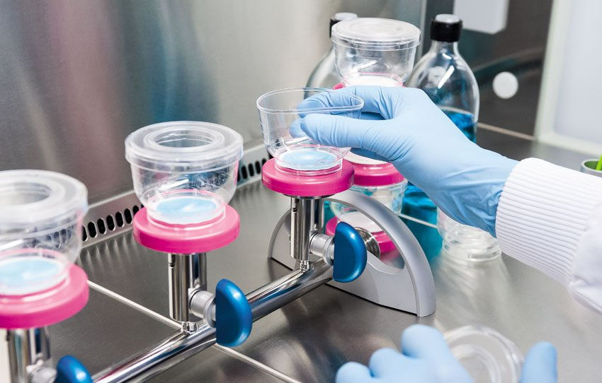 What is the Difference Between Bioburden and Endotoxin Test?