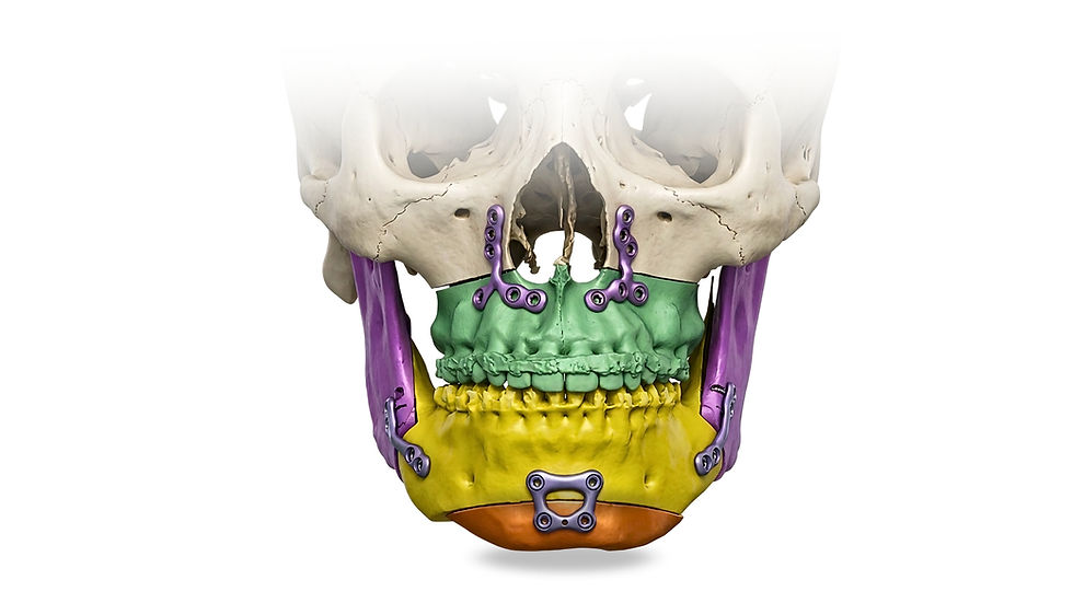 Catalogo Maxilofacial 3D Medical (1).png