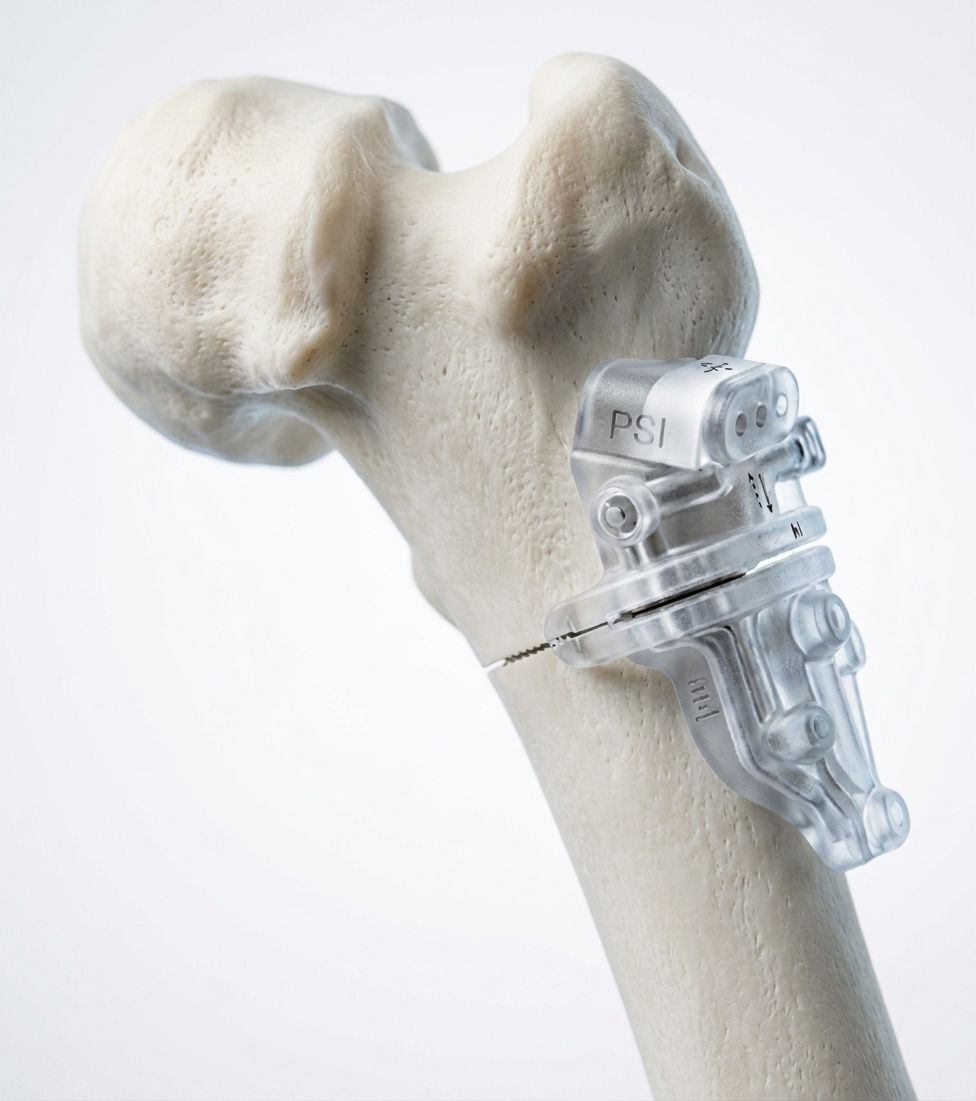 Osteotomia rodilla.jpg