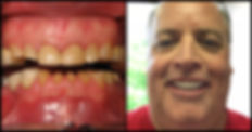 Patient Before and After