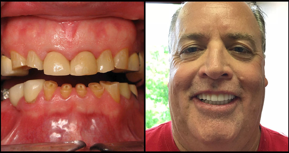 Patient Before and After