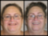 Patient Before and After