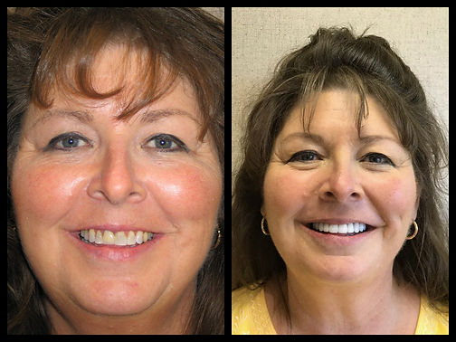 Patient Before and After