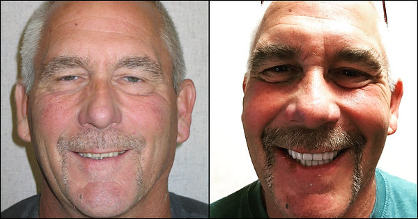Patient Before and After