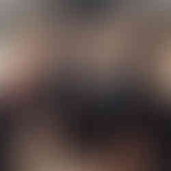 Spontana in posrečena