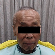 装着前 正面