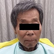 装着後 正面