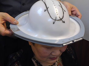 オーダーメイド型取り中