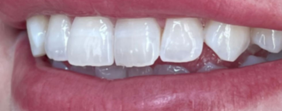 teeth for website.jpg