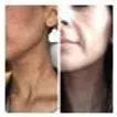 Thumbnail: Kem hữu cơ organic cho eczema và da nhạy cảm