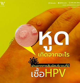 หูดเกิดจากอะไร