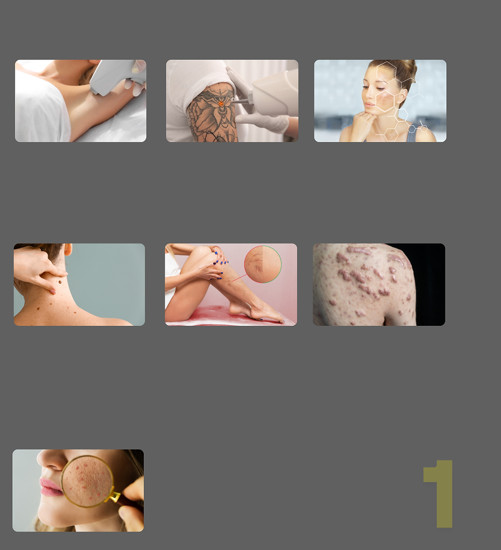 Draf On Web Laser (1).png