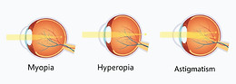 refractive.jpg