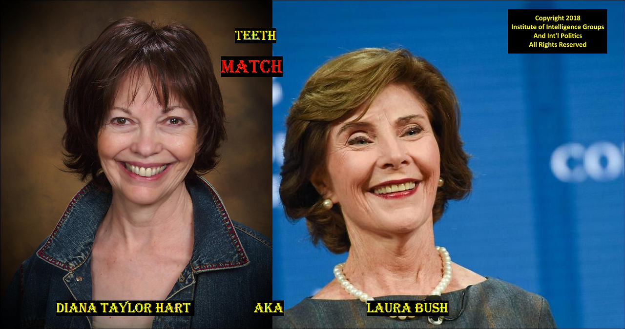 LAURA TEETH COMP DIANA TAYLOR MATCH