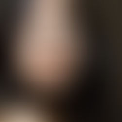 Natural Anti-Aging: Facial Rejuvenation Acupuncture