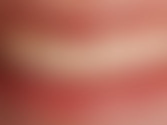 Before smile photo of a chipped and discolored front tooth before composite bonding