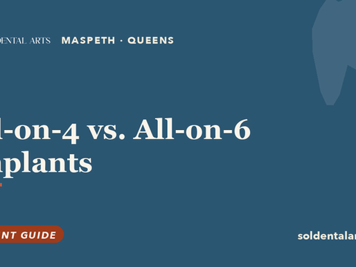 All-on-4 vs. All-on-6 vs. Full-Arch Implants: Understanding Your Options