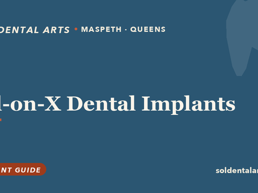 All-on-X Dental Implants in Queens, NYC: Full-Arch Implant Teeth Explained