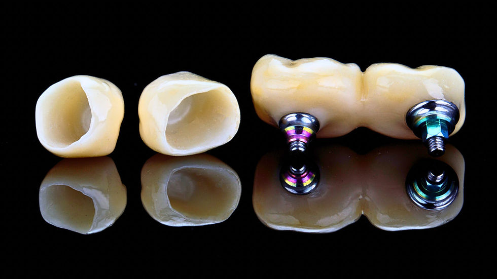 Dental Crowns and Bridges in Maspeth, Queens