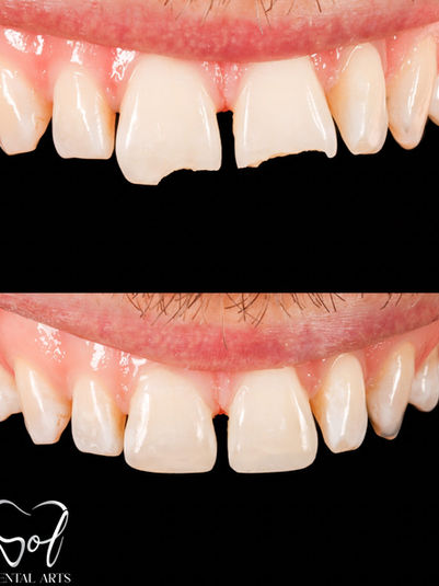 Emergency dental care at SOL Dental Arts in Maspeth Queens
