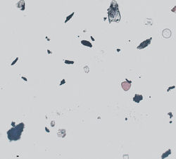 20 Feingestaubt_Teilchen invers